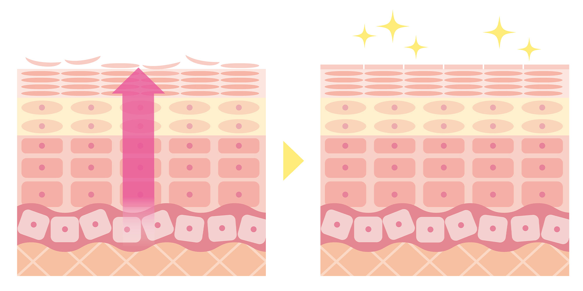 肌のターンオーバー